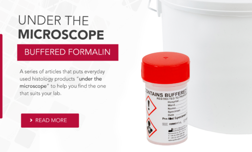 Under The Microscope: Buffered Formalin (NBF) – Solmedia