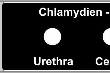 Diagnostic Slides PTFE, hydrophilic, black 2 x 6mm spot  Ref. 072